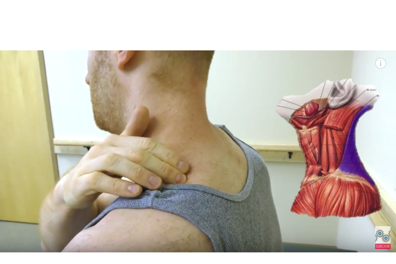 Trapezius muscle pain & trigger points